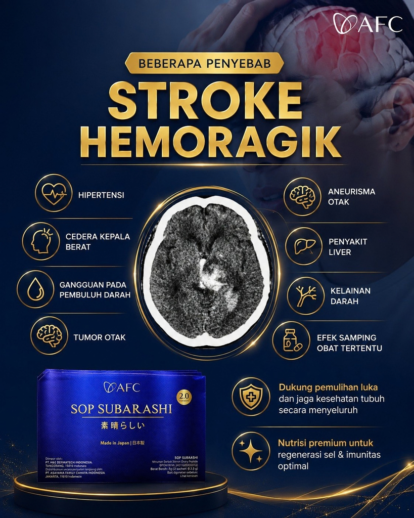 Beberapa Penyebab Stroke Hemoragik