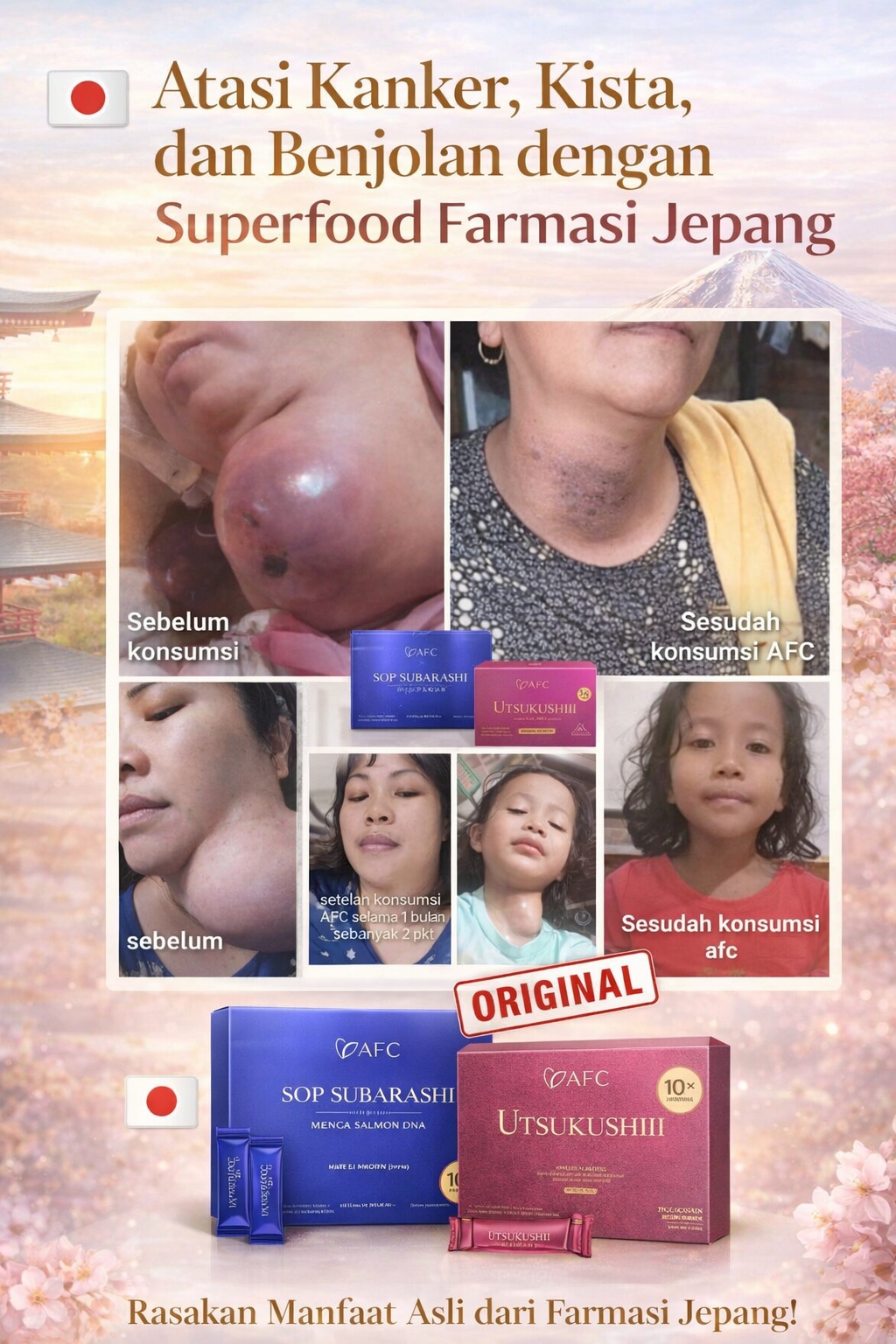 Testimoni SOP Subarashi dan Utsukushhii